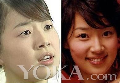 韩国整容院资料外泄 再掀明星变脸狂潮