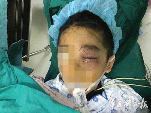 4岁男孩街头被抢 抢人女子逃跑时戳伤孩子眼睛