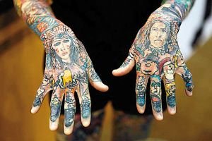 美国女子皮肤见光起水疱