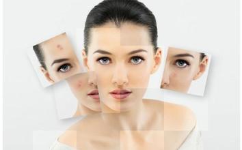 祛痘除疤最佳时间 你都知道吗