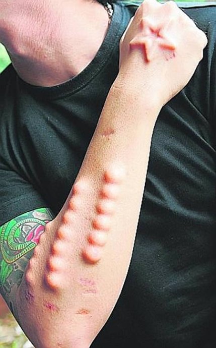 世界上最诡异的人体植入!