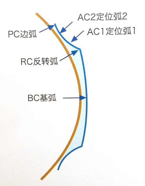 塑形镜的原理_△角膜塑形镜视力矫正原理(3)