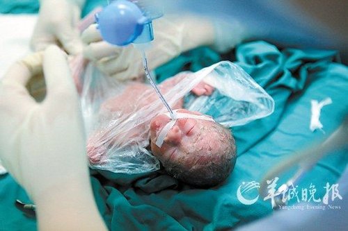 24岁女子产下5胞胎 3男<em>2女</em>体重均接近1千克_