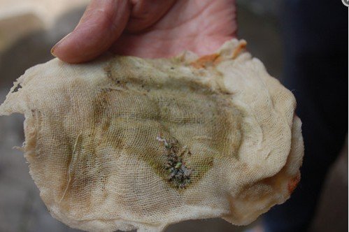 攀枝花同德镇居民长期食用含有蚂蝗的浑黄自来