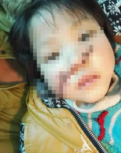 10岁女孩模仿光头强将妹妹锯伤