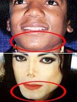 迈克尔杰克逊之死+只因整容惹得祸?