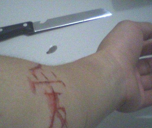生网上秀割腕自残照片