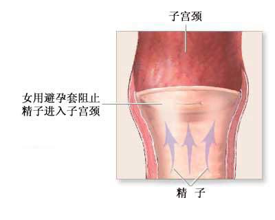 图解女性<em>避孕</em>法_重点推荐(图)_大渝网_腾讯网