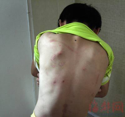 12岁女孩遭生父3年毒打多次被强奸(图)