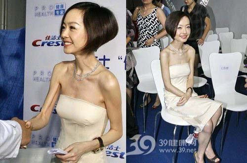 惊骇:女星盲目减肥瘦成皮包骨