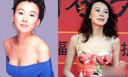 组图:盘点胸部严重 下垂的 美女 明星  有图为证_