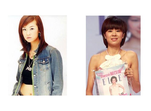 郁可唯又出状况 陷入整容门_整形新闻