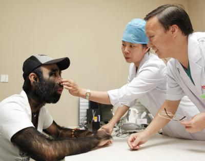 中国第一毛孩杭州脱毛 还想整容成美猴王