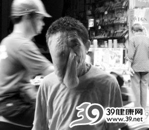 狼人症、鱼鳞人世界上最恐怖的病症(组图)