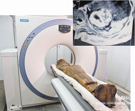 木乃伊的诅咒:古埃及人也有心脏病_国内国际