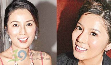 大渝导读:明星是否整容的话题,历久不衰