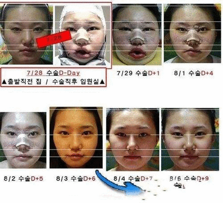 把人雷焦的组图:<em>韩国女人整容</em>太可怕了_整形新