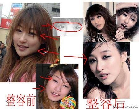 <em>整容前后</em>的网络第一<em>美女</em>刘羽琦<em>照片</em>对比_整形