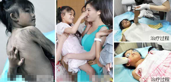 夏天慎用脱毛膏,4大危害等着你