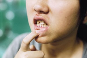 孩子两岁半玩耍时把牙磕掉了怎么办