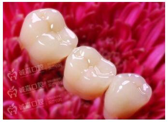 重庆哪里做烤瓷牙好?