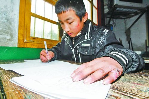 学生长着冻疮参考 老师年年雪中送卷_大渝网_腾讯网