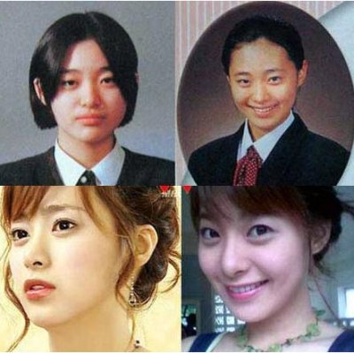 盘点<em>韩国整容失败女星</em>_大渝网_腾讯网