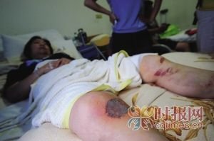 男子疑<em>与女邻居</em>有染 离婚后开车撞伤前妻_大渝