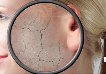 皮肤溃疡总不好小心皮肤癌 皮肤癌中医治疗方法_大渝网_腾讯网