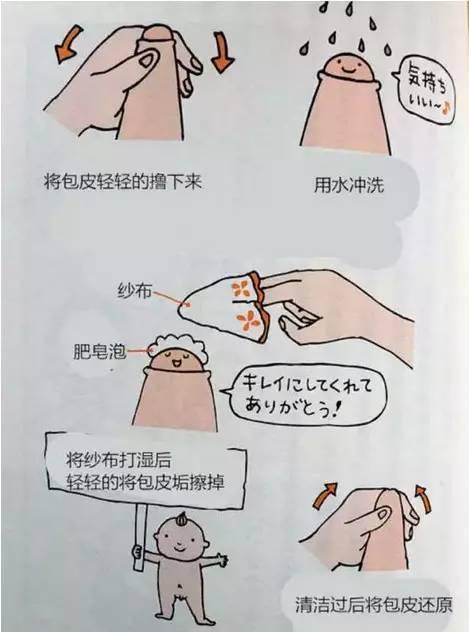 割包茎可以用社保吗 上海社保能报销割包皮