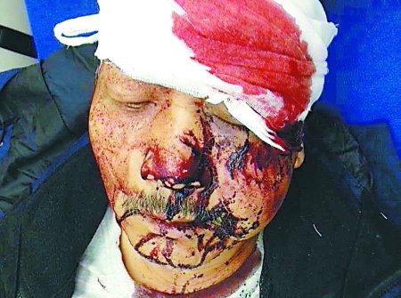 重庆老翁随女自驾川西 路上被当地司机围殴