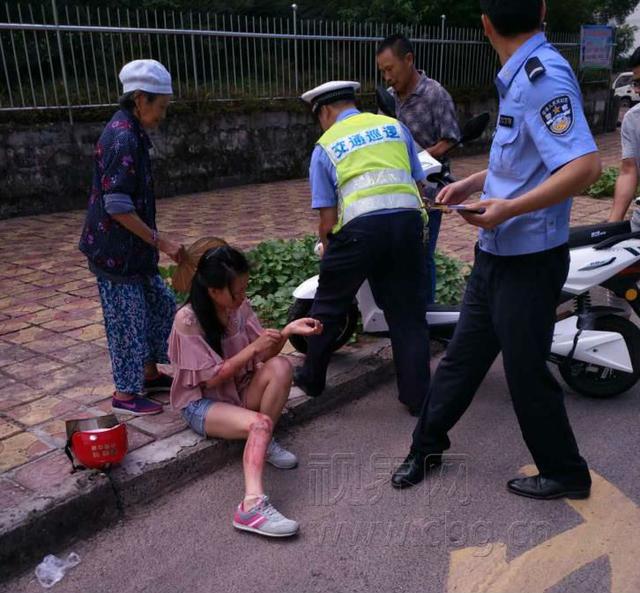 女子骑车摔伤腿 巡逻民警急送医