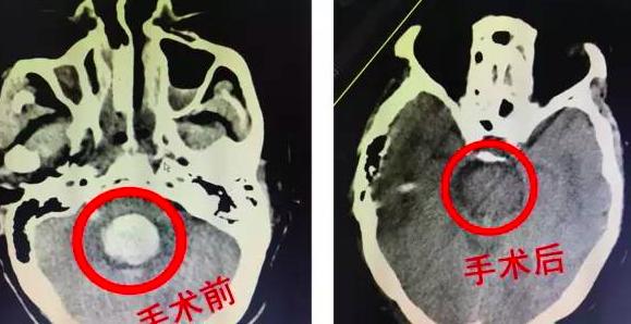 图自西南医院神经外科
