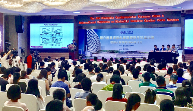 体外循环 重庆市人民医院率先实现心脏手术无