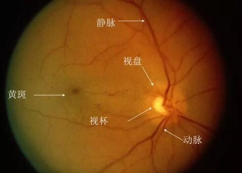 小伙高度近视想做近视手术 医生却不让