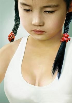 6岁的<em>女孩</em>乳头已增大