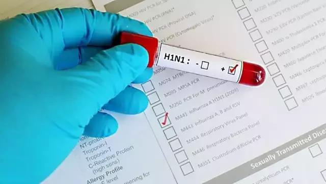 缅甸H1N1甲型流感已致26人死亡