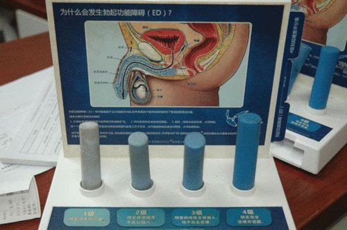实拍男科专家诊治性功能障碍全过程