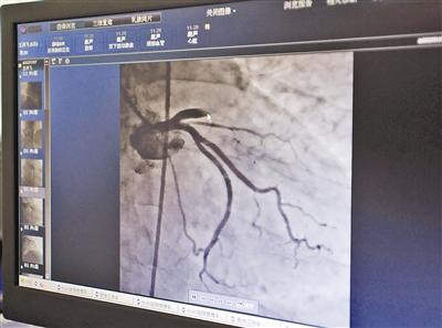 天天玩手机到凌晨5点 28岁男子突发心肌梗死