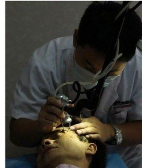 快速消除老年斑的方法--激光