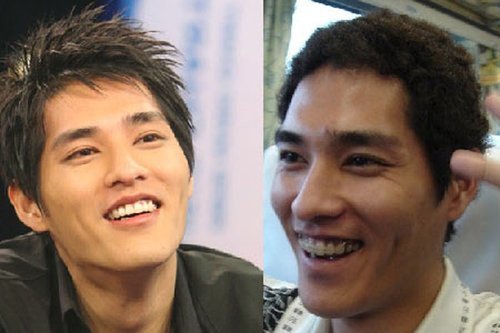 韩国明星金智秀整牙瘦脸前后对比图