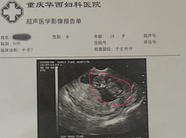 罪孽 — 我们帮18岁女孩做掉了成型磨胎 转>