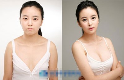 韩国女子整容对比照