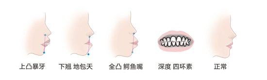 审美矫正丑牙会让你的形象减几分