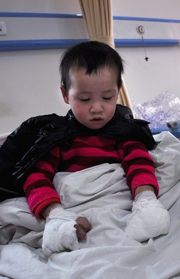 3岁手足畸形男孩出生被父母遗弃 却只会喊妈妈