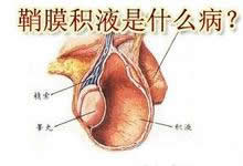 小儿睾丸鞘膜积液什么时候手术最好?