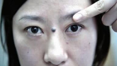 女子整容割了双眼皮 术后眼睛变一大一小(图)