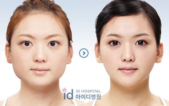 韩国整形脸骨提醒:摆脱国字脸应避免哪些恶习
