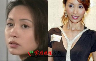 胡杏儿杨怡 细数TVB被传整容的女明星