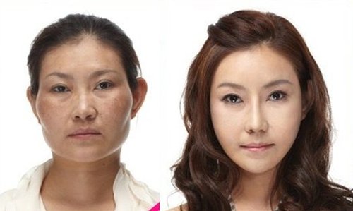 学生整形为求职 惊叹韩国整容术前后对比